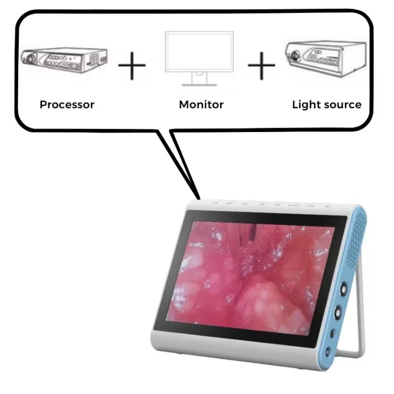 3‑In‑1 Medical Endoscopy Image - Medical Lab Images review and price
