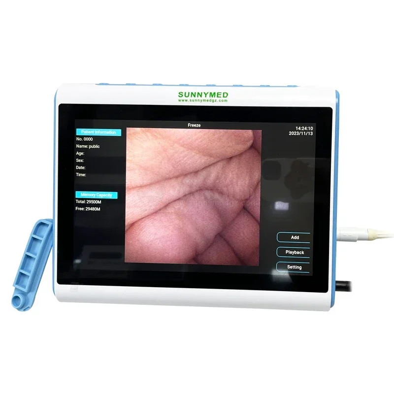 3‑In‑1 Medical Endoscopy Image - Medical Lab Images review and price