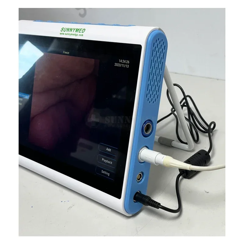 3‑In‑1 Medical Endoscopy Image - Medical Lab Images review and price
