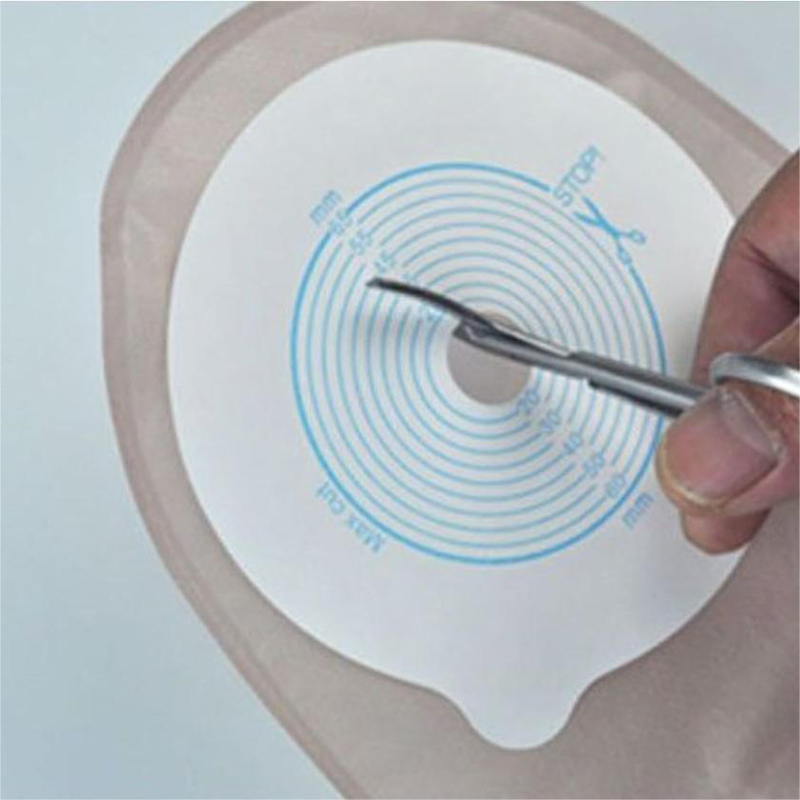 Ostomy Bags Scissors Round Hea - Medical Scissors review and price