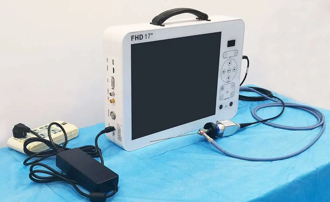 17 Inch HD Video Otoscope ENT  - Medical Lab Images review and price