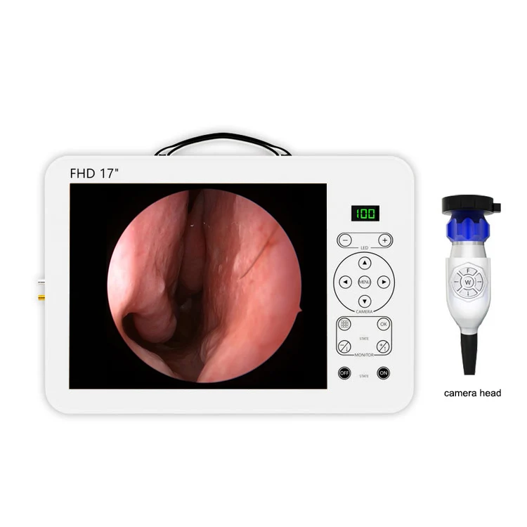 17 Inch HD Video Otoscope ENT  - Medical Lab Images review and price