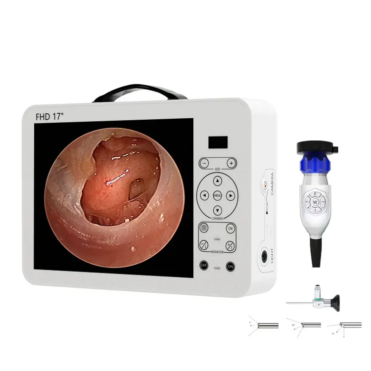 17 Inch HD Video Otoscope ENT  - Medical Lab Images review and price