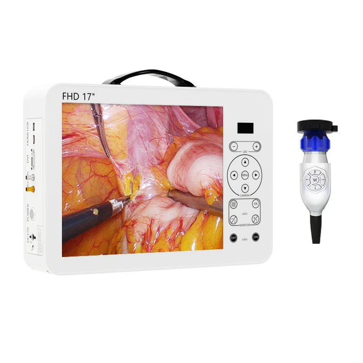 17 Inch HD Video Otoscope ENT  - Medical Lab Images review and price