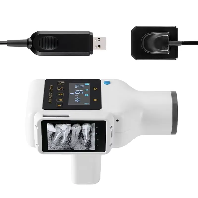 Portable Handheld Dental X Ray - Xlab Medical review and price